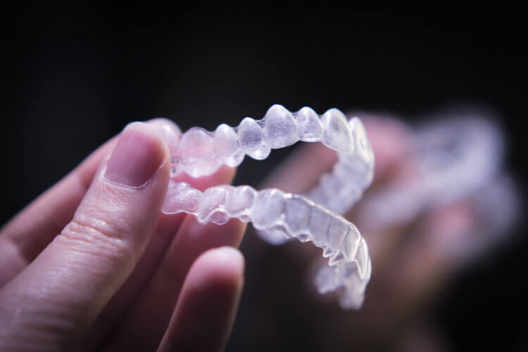 will Invisalign work for me